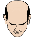 Cartoon illustration of a bald man.