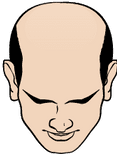 Cartoon illustration of a man with a receding hairline.