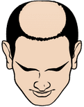 A man with a receding hairline.