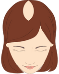 Illustration of a woman with hair loss.